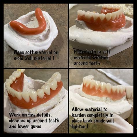 directions to affordable dentures|More.